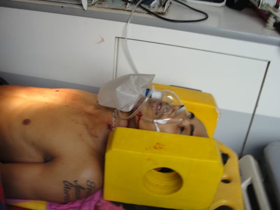 Jovem atingido por quatro tiros no Fênix