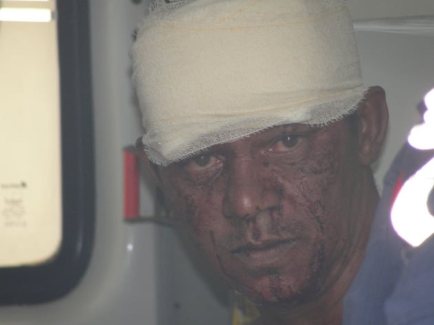 Soldador leva três golpes de facão na cabeça e nas costas no Clóvis Alvim II