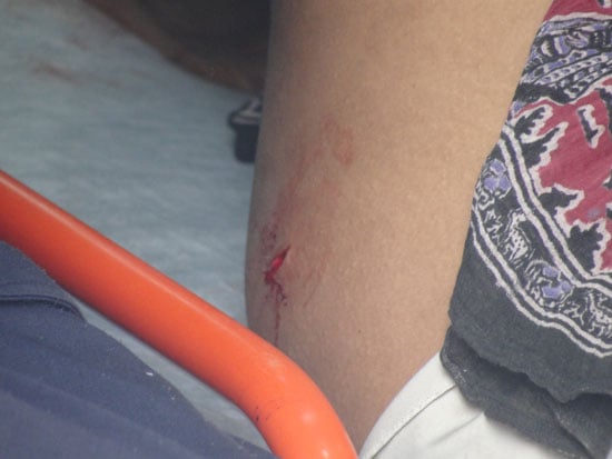Após discussão, rapaz esfaqueia irmã no bairro São Pedro