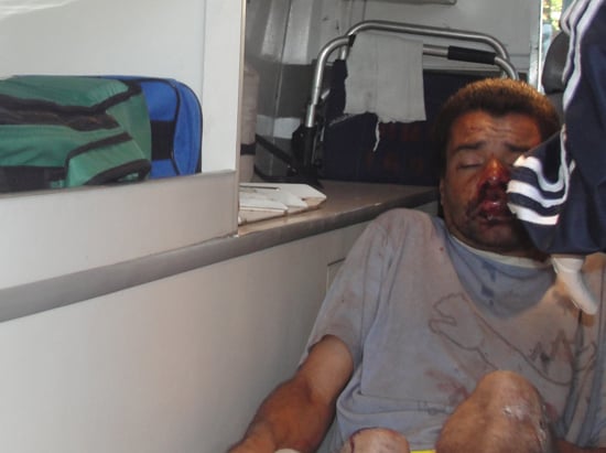 Roubo seguido de espancamento no Juca Batista