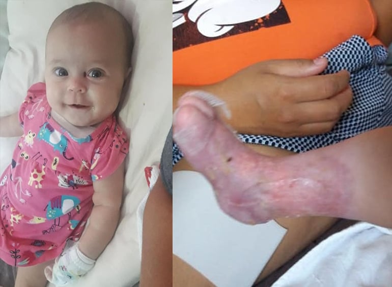 Família cria vakinha para custear remédios de bebê com doença rara