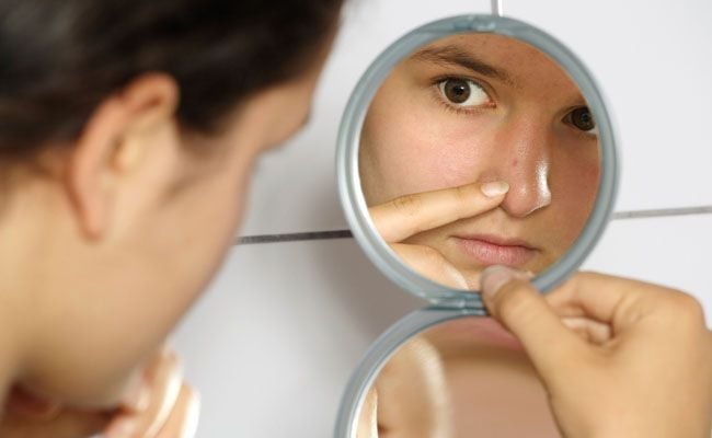 Acne: conheça os alimentos que ajudam na prevenção