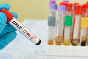Casos de sífilis aumentam 34,2% em Minas Gerais