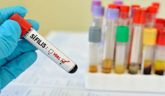 Casos de sífilis aumentam 34,2% em Minas Gerais