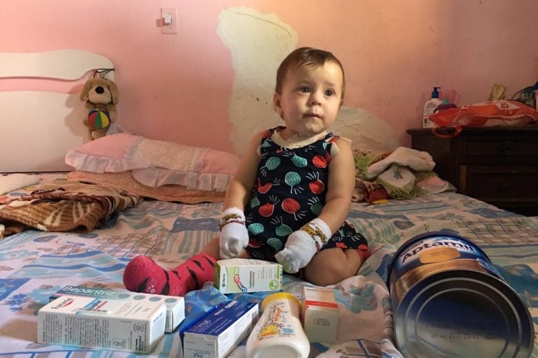 Família de bebê com doença de pele rara pede ajuda para tratamento