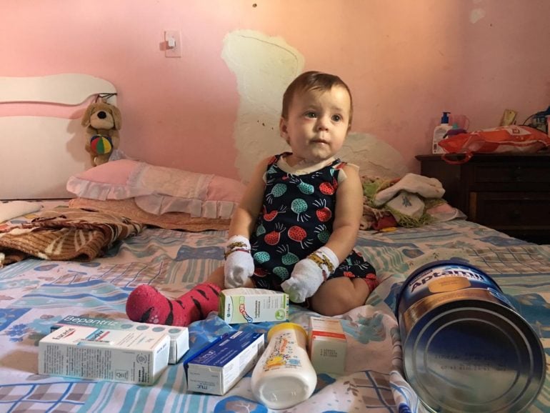 Família de bebê com doença de pele rara pede ajuda para tratamento