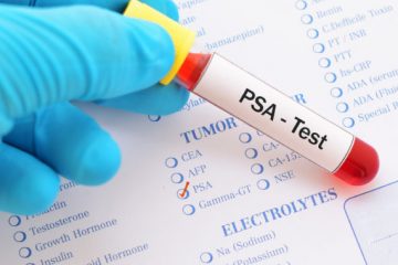 Mutirão em Itabira terá exames de sangue que identificam câncer de próstata