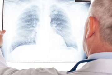 Pneumonia é a principal causa de morte em crianças menores de cinco anos em todo o mundo