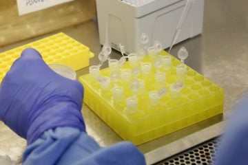 Cai para 11 o número de suspeitas de infecção por coronavírus no país