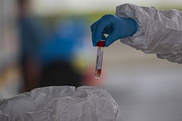 Vale diz que distribuição de testes ficará a cargo do governo federal