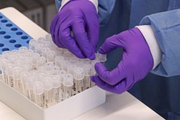 Saiba tudo sobre o novo coronavírus e a doença que ele provoca