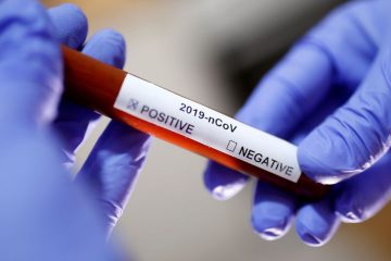 Brasil registra mais de 400 mortes por covid-19 nas últimas 24 horas