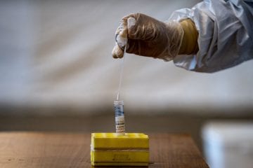 Visando entre 80 e 100 testes, presidente do Santa Cruz vê apoio da FPF como insuficiente