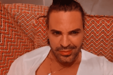 Eduardo Costa choca ao revelar que ficou com rosto desfigurado após grave acidente