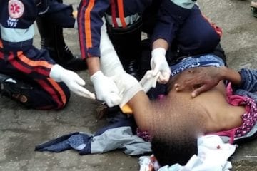 Baleado no São Pedro poderá ser transferido para um hospital em Belo Horizonte