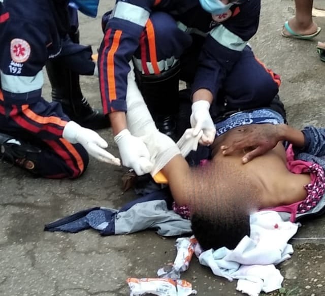 Baleado no São Pedro poderá ser transferido para um hospital em Belo Horizonte