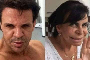 Eduardo Costa vira motivo de chacota depois de procedimento e é comparado Gretchen