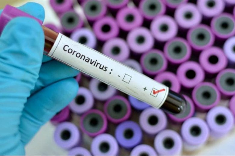 Coronavírus: Ipatinga registra mais uma morte; total chega a 43