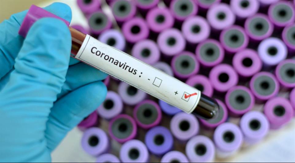 Coronavírus: Ipatinga registra mais uma morte; total chega a 43