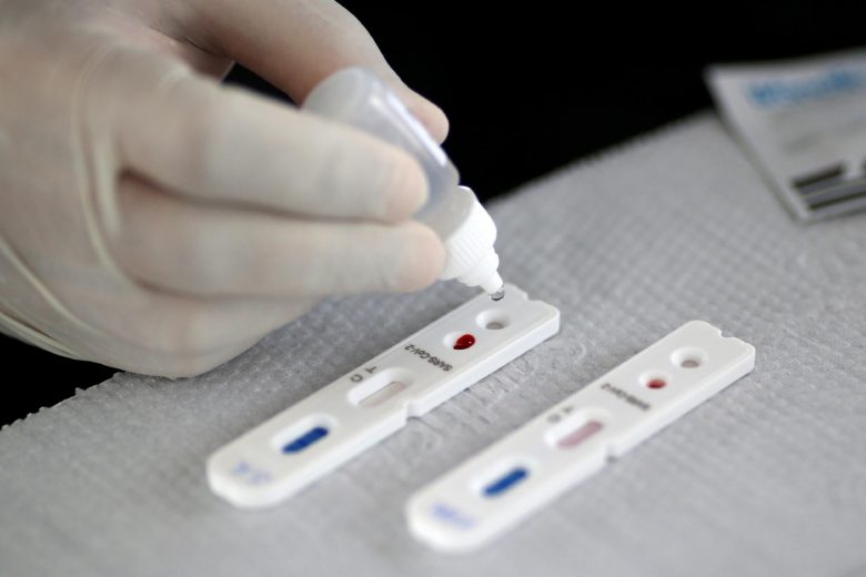 Ferros inicia testes rápidos de Covid-19 em profissionais da saúde