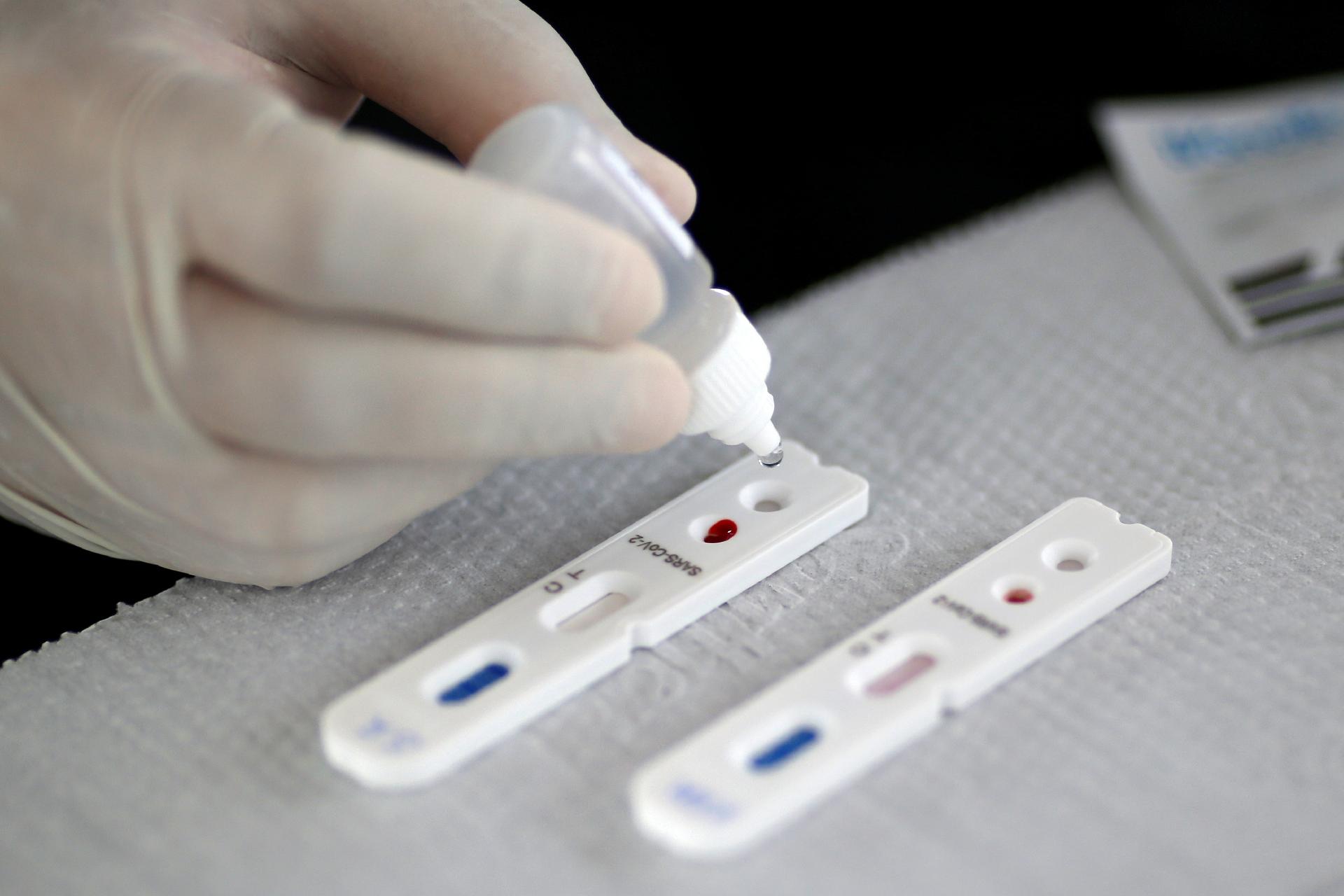 Ferros inicia testes rápidos de Covid-19 em profissionais da saúde