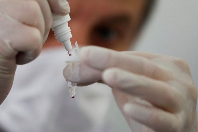 Minas registra 1.779 novos casos e 34 óbitos por coronavírus em 24h