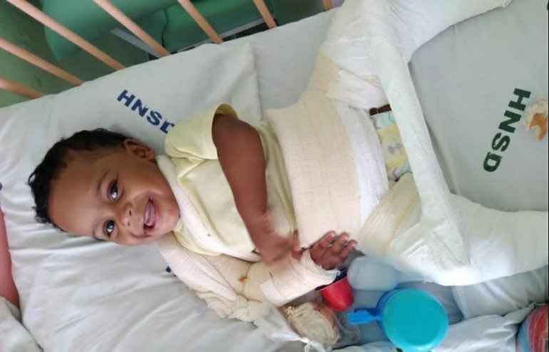 Mãe pede ajuda para filho com doença dos ossos de vidro em Itabira