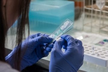 Estado investe em 20 mil testes para covid-19