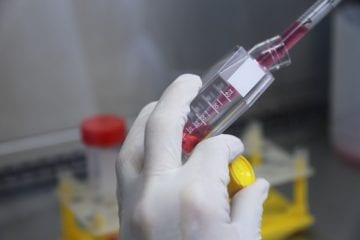 Vacina brasileira contra Covid-19 recebe apoio da Anvisa