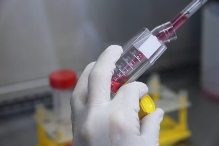 Vacina brasileira contra Covid-19 recebe apoio da Anvisa