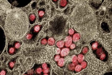 UFMG identifica primeira reinfecção de Covid-19 com nova mutação
