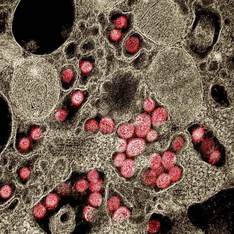 UFMG identifica primeira reinfecção de Covid-19 com nova mutação
