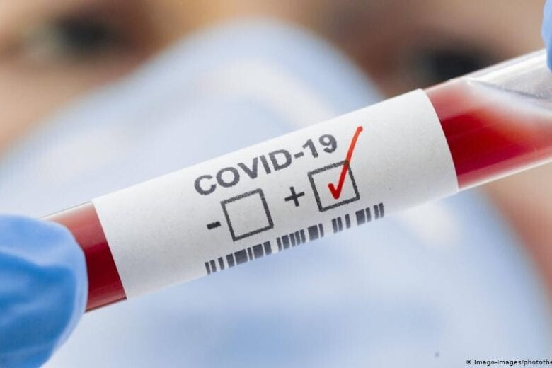 Em 24h, Minas Gerais tem 4.707 novos casos e 32 óbitos por Covid-19
