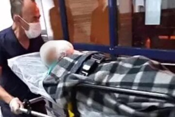 Garoto de 9 anos é ferido com tiro no rosto após colega achar arma escondida
