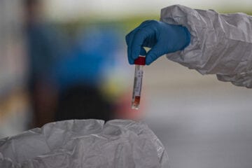 Itabira notifica duas mortes e dez novos casos de Covid-19