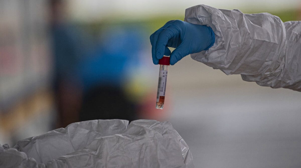 Itabira notifica duas mortes e dez novos casos de Covid-19