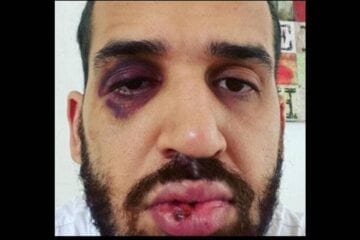 Após defender lockdown, médico é agredido com chutes e socos