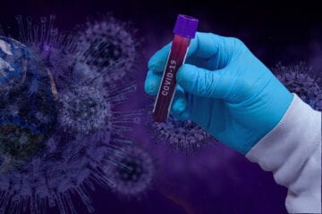 Itabira notifica três mortes e 52 novos casos de Covid-19