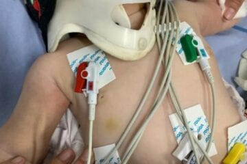 Médica atende bebê com mais de 30 lesões e aciona a polícia