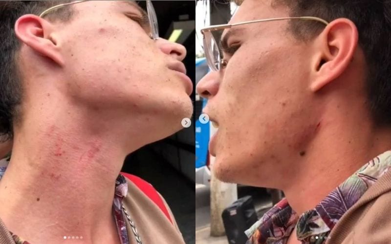 Segurança do metrô dá mata-leão em artista de rua; veja o vídeo