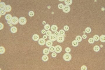 Exames que identificam fungos que afetam sistema nervoso entram no SUS