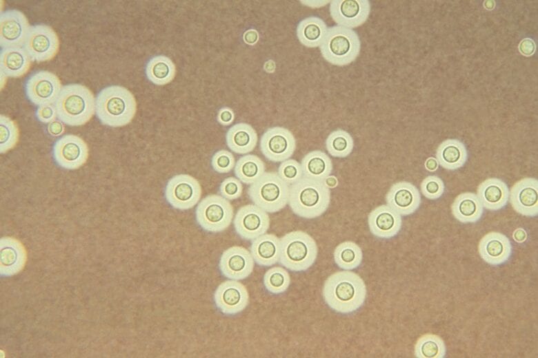 Exames que identificam fungos que afetam sistema nervoso entram no SUS