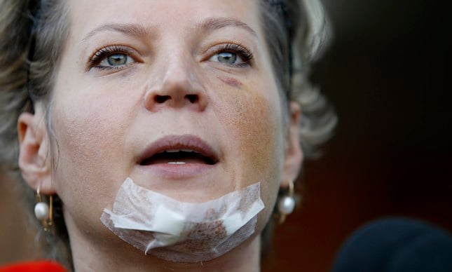 Perícia da Câmara: ninguém estranho entrou no prédio de Joice Hasselmann