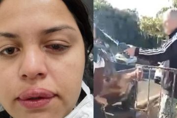 Faxineira é atacada com ácido pelo ex-patrão; veja vídeo