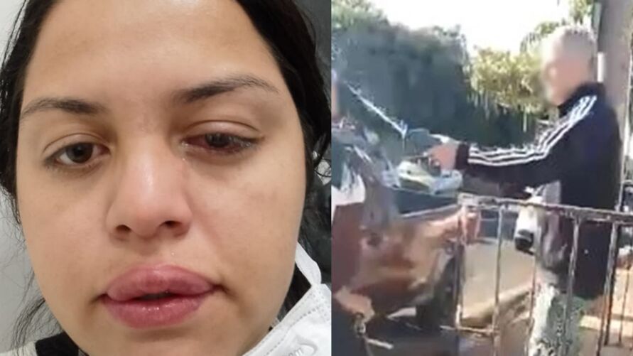 Faxineira é atacada com ácido pelo ex-patrão; veja vídeo