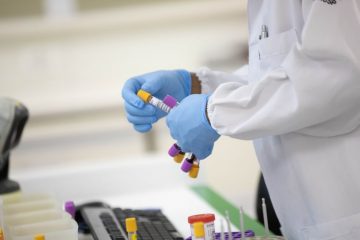Caso Faustão: em todo o país 46 mil pessoas aguardam órgãos na fila de transplante