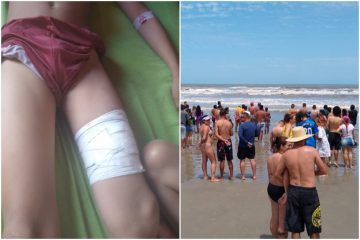 Ataque de tubarão: animal fere criança e provoca pânico em praia paulista