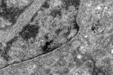 Covid-19: o que se sabe até agora da variante Ômicron
