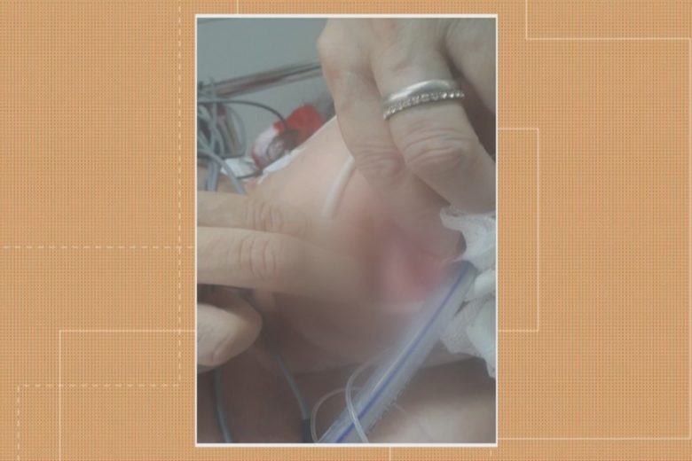 Paciente internada no hospital Santa Maria é encontrada com larvas na boca e no nariz