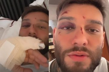 Lucas Lucco desmaia em casa e fratura um dedo após exagerar na bebida
